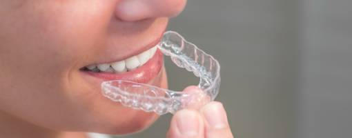 Woman Wearing Orthodontic Silicone Trainer. Invisible Braces Aligner. 