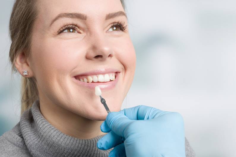 What Are Veneers? Your Secret to a Perfect Smile!