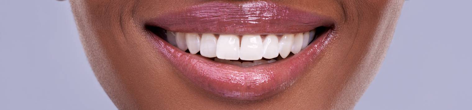 Lady smiling with teeth close-up.